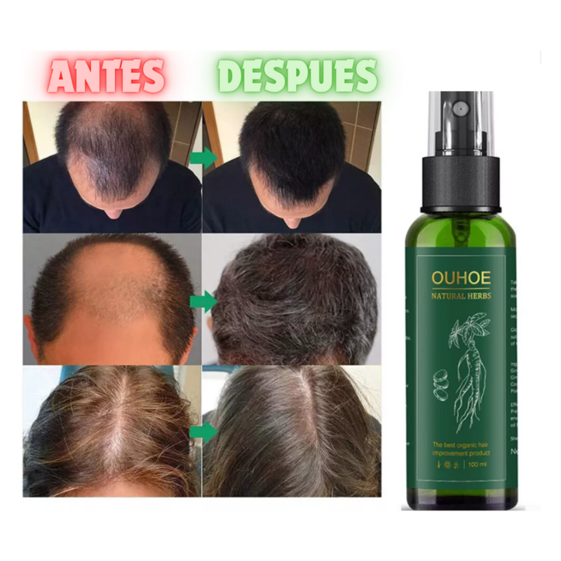 TONICO CAPILAR NATURAL OUHOE™ EN SPRAY PARA UN CRECIMIENTO FUERTE Y SALUDABLE DEL CABELLO🌿