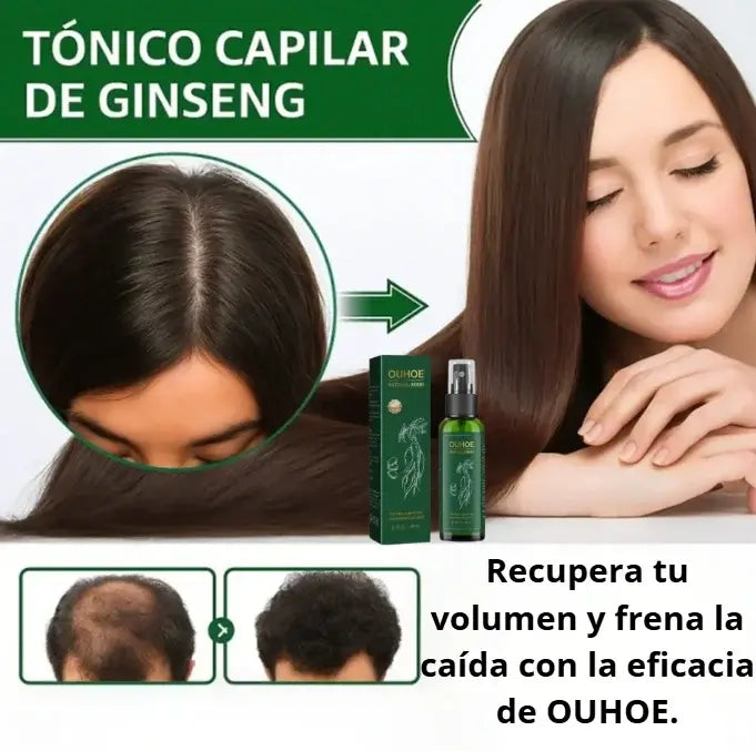 TONICO CAPILAR NATURAL OUHOE™ EN SPRAY PARA UN CRECIMIENTO FUERTE Y SALUDABLE DEL CABELLO🌿