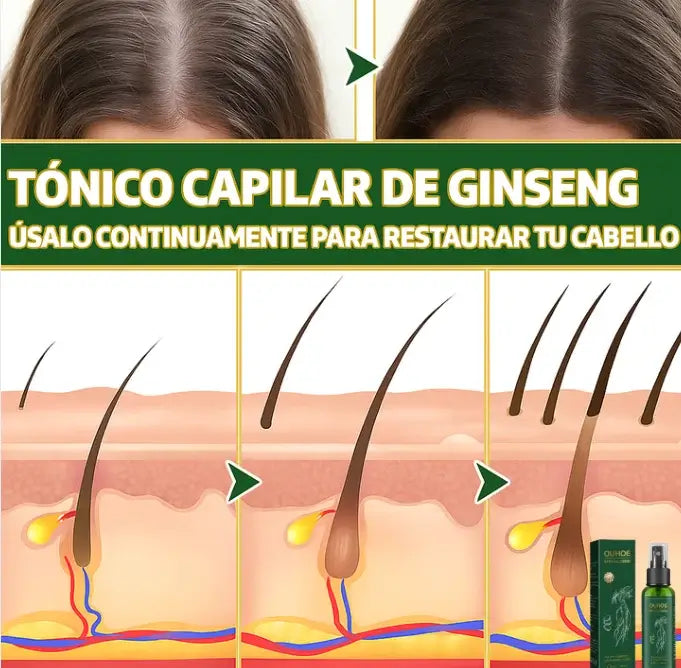 TONICO CAPILAR NATURAL OUHOE™ EN SPRAY PARA UN CRECIMIENTO FUERTE Y SALUDABLE DEL CABELLO🌿
