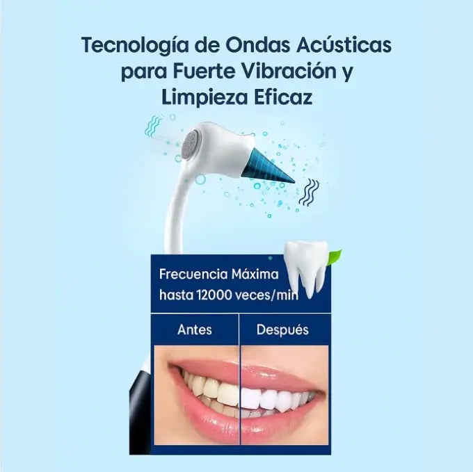 KIT LIMPIADOR ORAL ULTRASÓNICO – DIENTES MÁS LIMPIOS SONRISA MÁS SEGURA