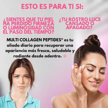 💜 MULTI COLLAGEN PEPTIDES® – VITALCOM DELUXE  Nutre tu belleza desde adentro y dale vitalidad a tu piel, cabello y articulaciones. ✨