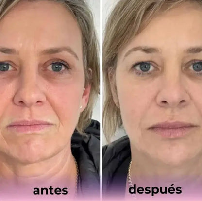 MASCARILLA DE COLÁGENO, EL SECRETO PARA UNA PIEL MÁS JOVEN. DISPONIBLE EN SET DE 4, 8 O 12 UNIDADES