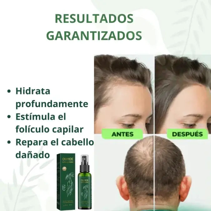 TONICO CAPILAR NATURAL OUHOE™ EN SPRAY PARA UN CRECIMIENTO FUERTE Y SALUDABLE DEL CABELLO🌿