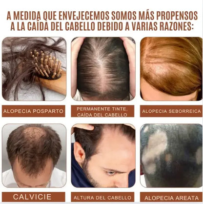 KIT ACEITE DE BATANA. CABELLO QUE HABLA POR TI... RECUPERA TU BRILLO, FUERZA Y CONFIANZA DESDE LA RAÍZ💫