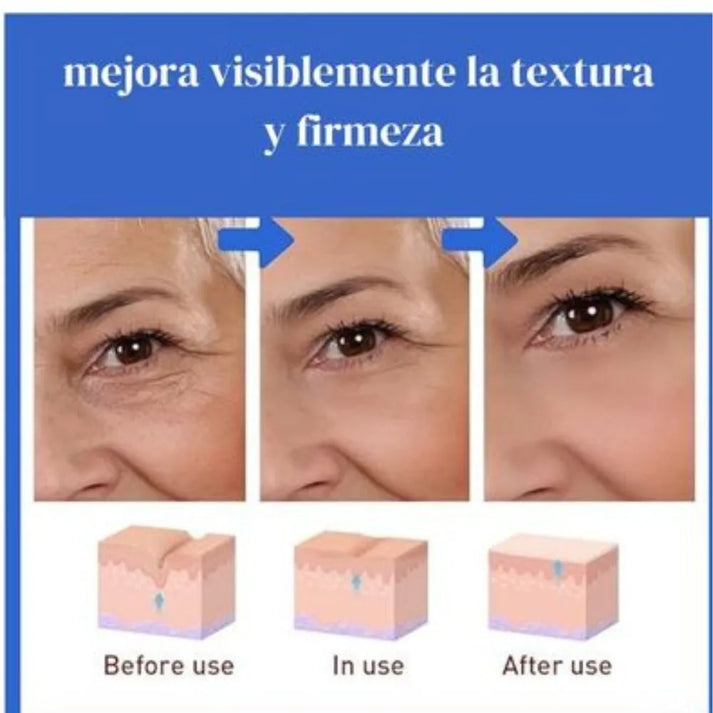 💧 SERUM HIDRATANTE CON COLÁGENO- BOTOX STOCK SOLUTION. Apoya la firmeza natural de tu piel y realza su luminosidad.