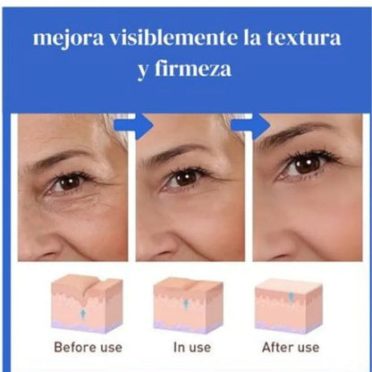 💧 SERUM HIDRATANTE CON COLÁGENO- BOTOX STOCK SOLUTION. Apoya la firmeza natural de tu piel y realza su luminosidad.